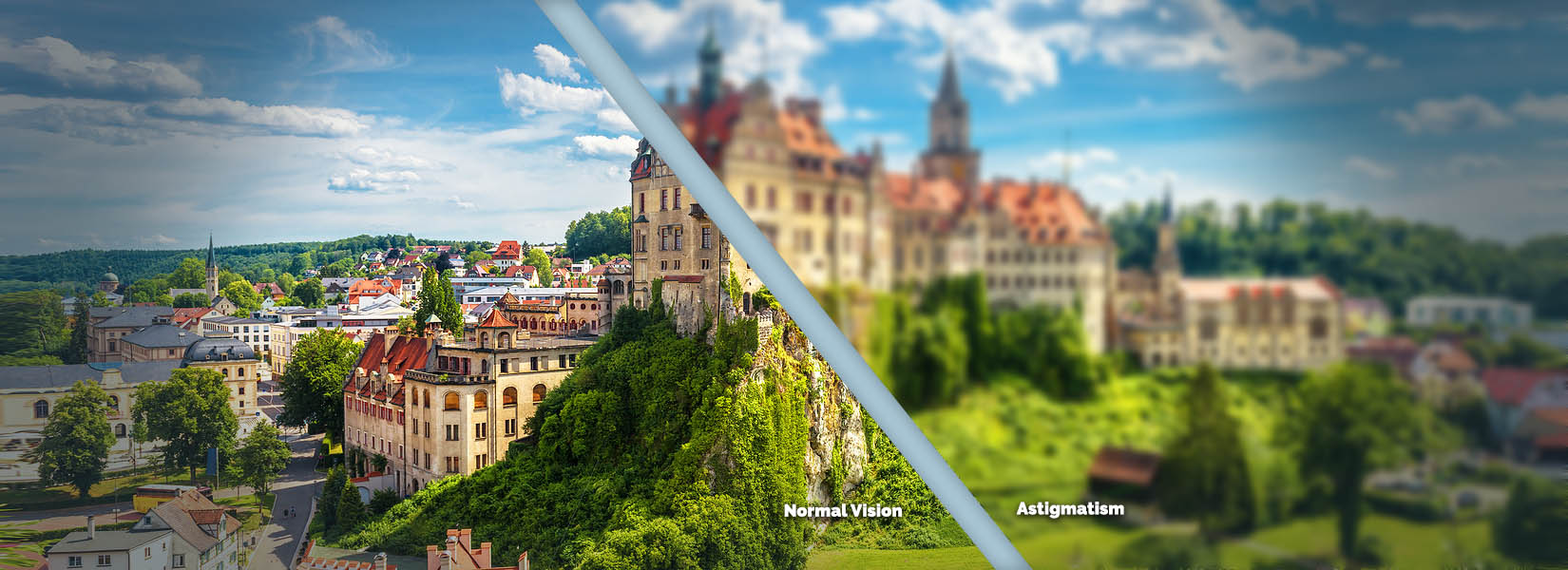Astigmatism Treatment in Rochester