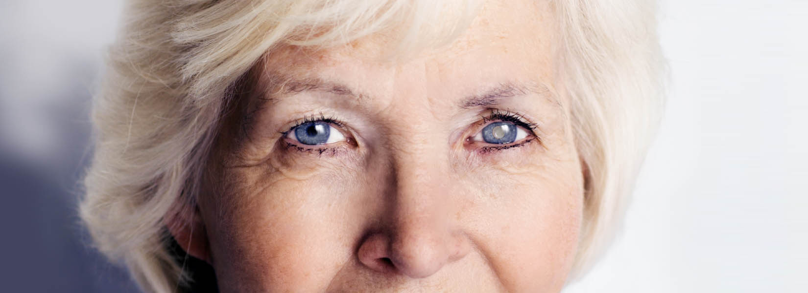 Cataract Surgery in Rochester